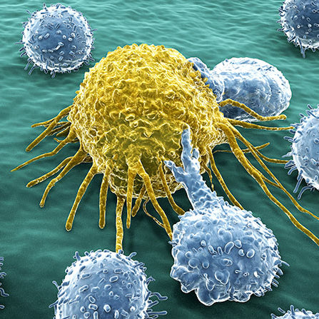 The Importance of Natural Killer Cells in Cancer Immunology